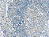 Immunohistochemistry of paraffin-embedded Human tonsil tissue using HASPIN Polyclonal Antibody at dilution of 1:55(×200)