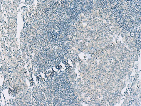 Immunohistochemistry of paraffin-embedded Human tonsil tissue using HASPIN Polyclonal Antibody at dilution of 1:55(×200)