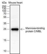 Anti-Human/Mouse MBL2 Antibody [A694]