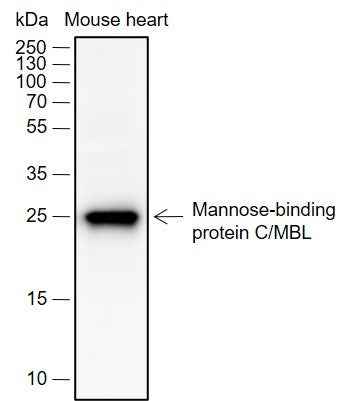 Anti-Human/Mouse MBL2 Antibody [A694]