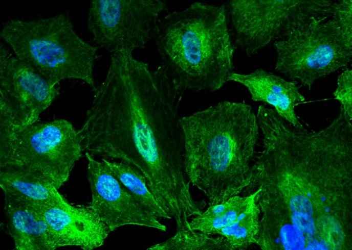 Anti-Human KYNU Antibody [A1188] - ABMIUM