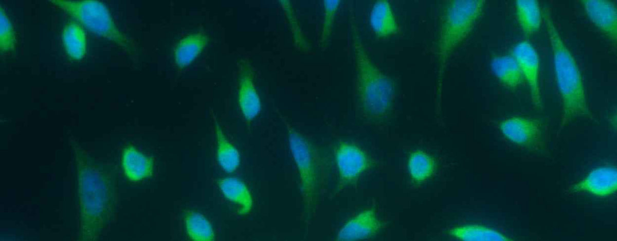 Anti-Human LAMP3 Antibody [A1212] - ABMIUM