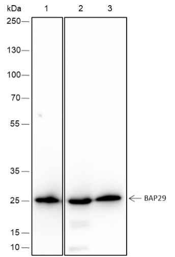 Anti-Human BAP29 Antibody [A422] - ABMIUM