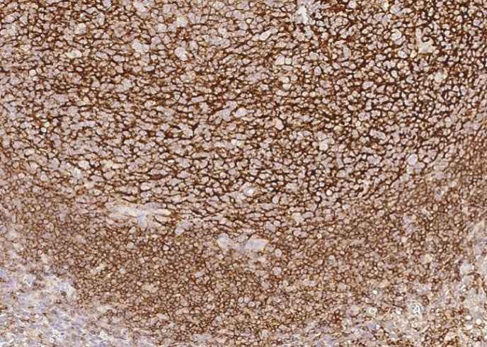 Anti-Human/Cynomolgus/Ferret CR2 Antibody [A857] - ABMIUM