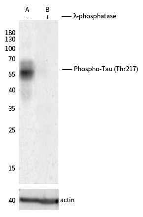 Anti-Human MAPT Antibody [B303] - ABMIUM