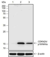 Anti-Human CDKN2A/p16INK4a Antibody [A711]