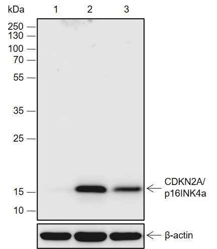 Anti-Human CDKN2A/p16INK4a Antibody [A711] - ABMIUM