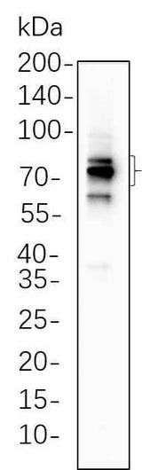 Anti-Human/Mouse/Rat FOXP1 Antibody [B547]