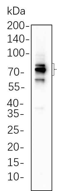 Anti-Human/Mouse/Rat FOXP1 Antibody [B547] - ABMIUM