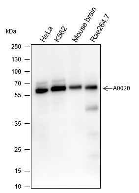 Anti-Human/Rat/Mouse ELP3 Antibody [A272] - ABMIUM