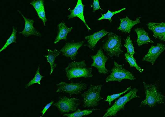 Anti-Human NGFR Antibody [B362] - ABMIUM