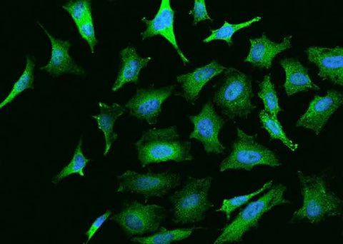 Anti-Human NGFR Antibody [B362] - ABMIUM