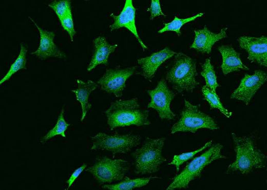 Anti-Human NGFR Antibody [B362] - ABMIUM