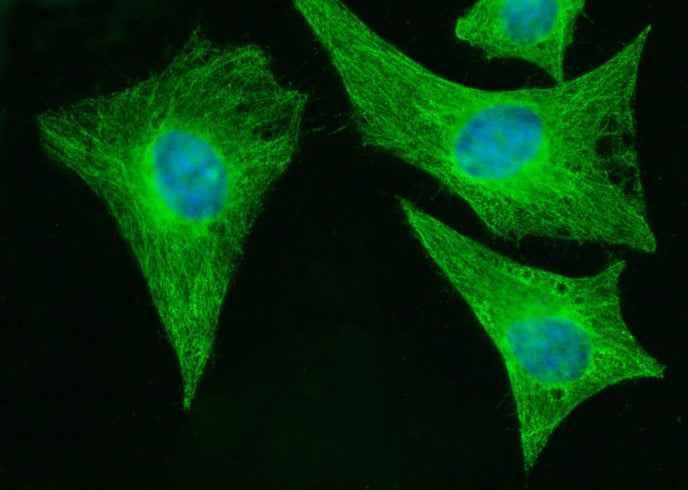 Anti-Human MOB1B Antibody [A1086] - ABMIUM