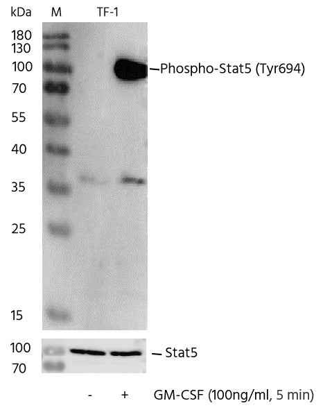 Anti-Human STAT5a Antibody [B305] - ABMIUM