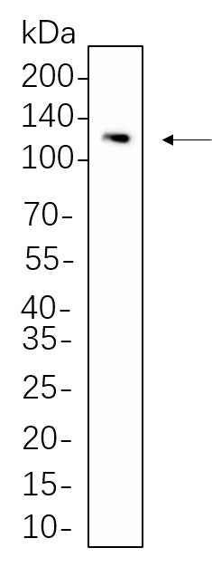 Anti-Human/Mouse/Rat Stat2 Antibody [B611] - ABMIUM