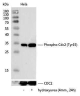 Anti-Human CDK1 Antibody [A1266] - ABMIUM