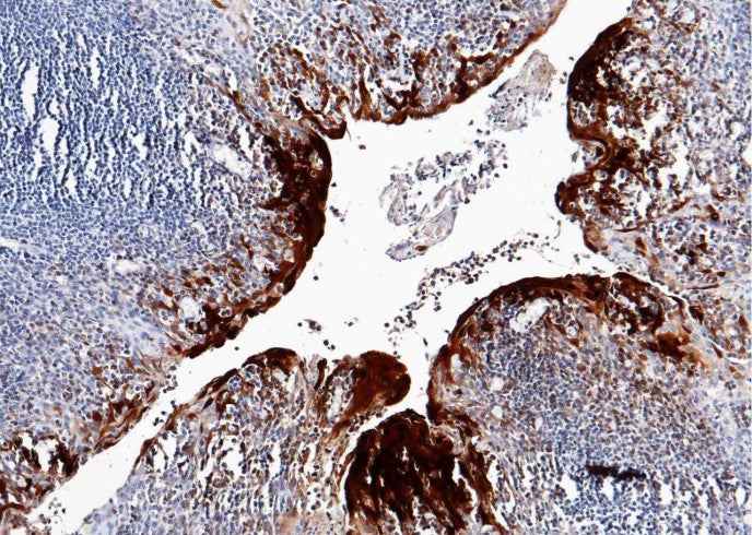 Anti-Human S100A7 Antibody [B309] - ABMIUM