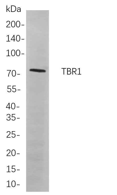 Anti-Human/Mouse/Rat TBR1 Antibody [B865] - ABMIUM