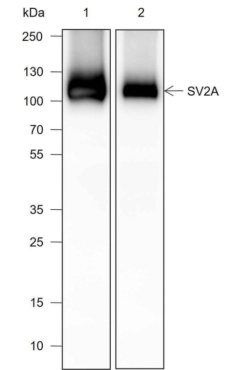 Anti-Human/Rat/Mouse SV2A Antibody [A710] - ABMIUM