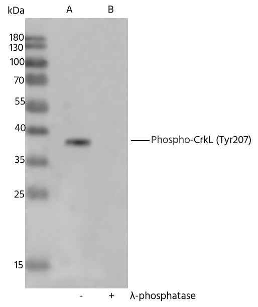 Anti-Human CRKL Antibody [A1271] - ABMIUM
