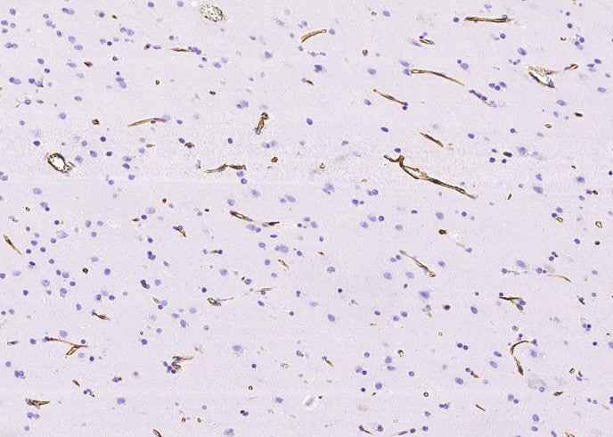 Anti-Human NES Antibody [A1024] - ABMIUM