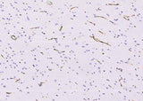 Anti-Human NES Antibody [A1024] - ABMIUM