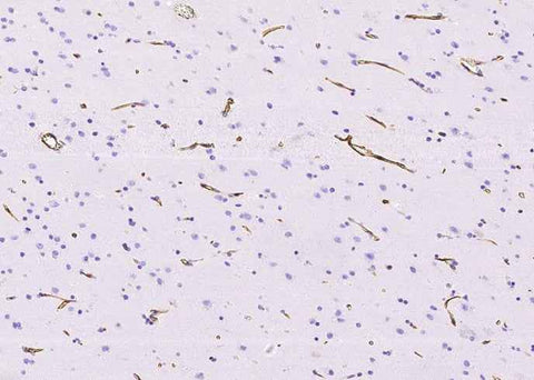Anti-Human NES Antibody [A1024] - ABMIUM