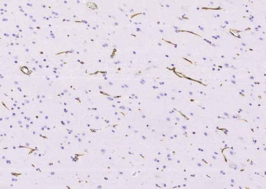 Anti-Human NES Antibody [A1024] - ABMIUM