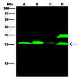Anti-Human CTSL Antibody [B263]