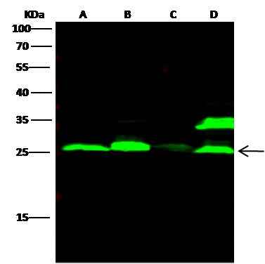 Anti-Human CTSL Antibody [B263] - ABMIUM
