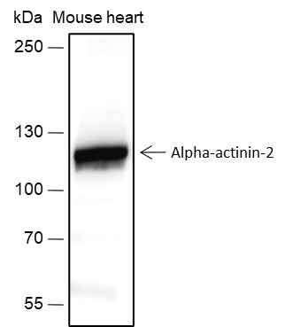 Anti-Human/Rat/Mouse alpha Actinin 2 Antibody [A463] - ABMIUM