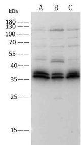Anti-Mouse TACSTD2 Antibody [B501]