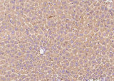 Anti-Mouse TFRC Antibody [B485]