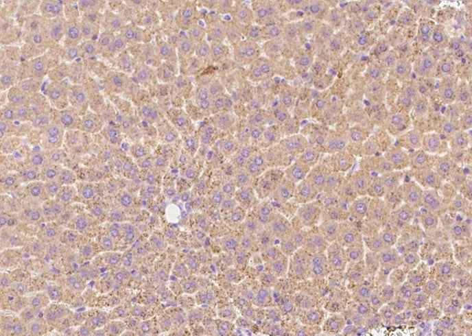 Anti-Mouse TFRC Antibody [B485] - ABMIUM