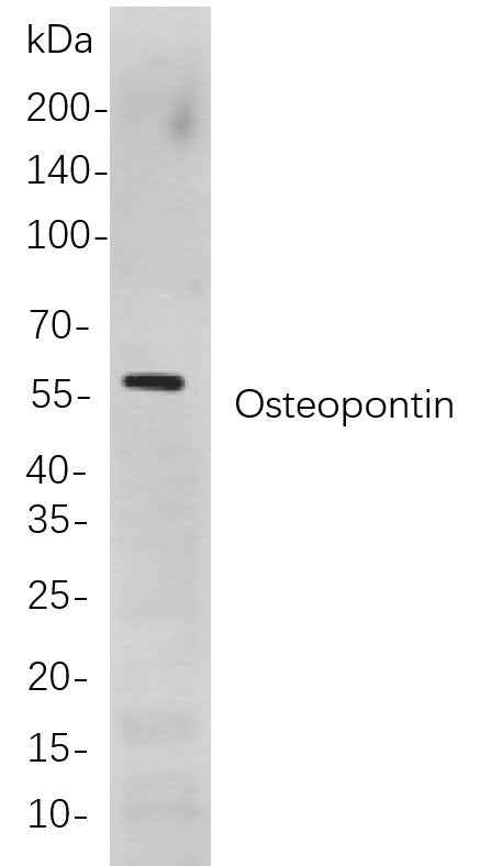 Anti-Human/Mouse/Rat Osteopontin Antibody [B843] - ABMIUM