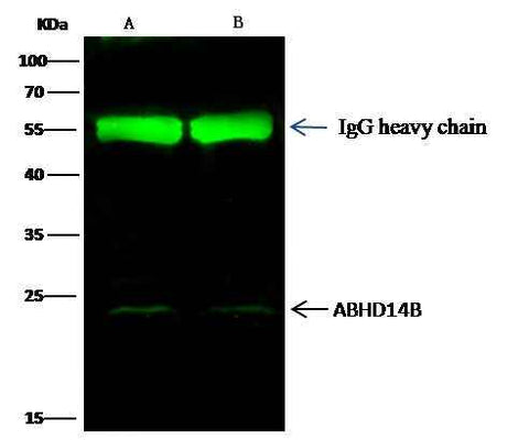 Anti-Human ABHD14B Antibody [B191] - ABMIUM