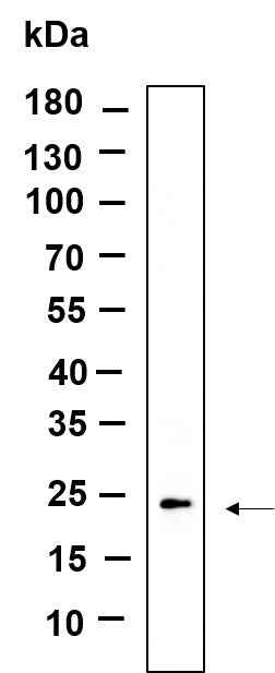 Anti-Human/Mouse/Rat GPX1 Antibody [B922] - ABMIUM