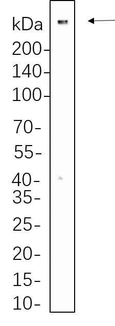 Anti-Human 53BP1 Antibody [B1136] - ABMIUM