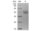 Recombinant Human ESAM Protein (aa 30-247, His Tag) - ABMIUM