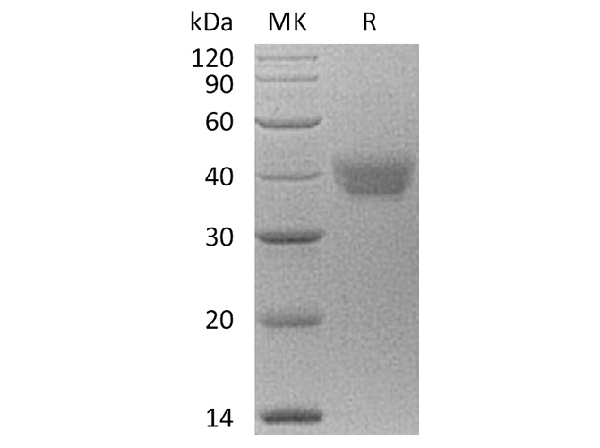 Recombinant Human ESAM Protein (aa 30-247, His Tag) - ABMIUM