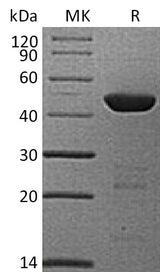 Recombinant Human HPD/4HPPD Protein (His Tag) - ABMIUM