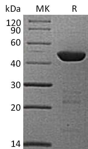 Recombinant Human HPD/4HPPD Protein (His Tag) - ABMIUM