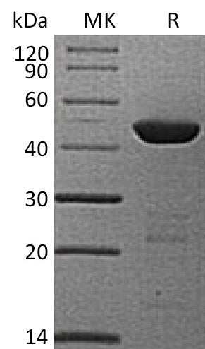 Recombinant Human HPD/4HPPD Protein (His Tag) - ABMIUM