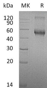 Recombinant Mouse ALK-1/ACVRL1 Protein (Fc Tag) - ABMIUM