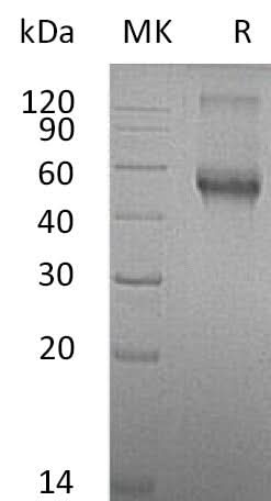 Recombinant Mouse ALK-1/ACVRL1 Protein (Fc Tag) - ABMIUM