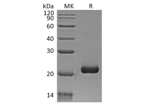 Recombinant Human IFN-λ3/IL-28B Protein (Human Cells, His Tag) - ABMIUM