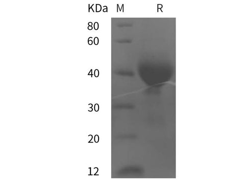 SDS-PAGE analysis of Human Tissue Factor/CD142 proteins, 2 μg/lane of Recombinant Human Tissue Factor/CD142 proteins was resolved with SDS-PAGE under reducing conditions, showing bands at 40 kDa.