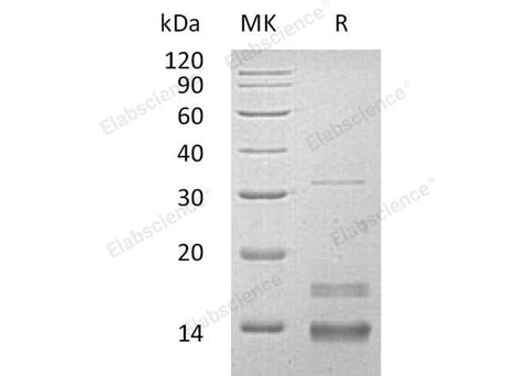 Recombinant Human CD72/Lyb-2 Protein (Trx&His) - ABMIUM