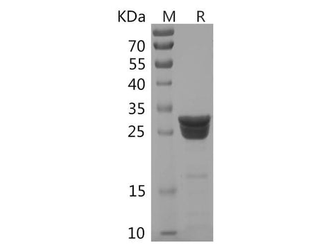 SDS-PAGE analysis of Human MR-ProADM proteins, 2 μg/lane of Recombinant Human MR-ProADM proteins was resolved with SDS-PAGE under reducing conditions, showing bands at 32 kDa.